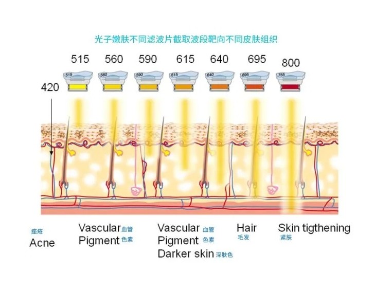 五大光子嫩膚技術(shù)（IPL、DPL、OPT、APT、BBL）及濾光片區(qū)別